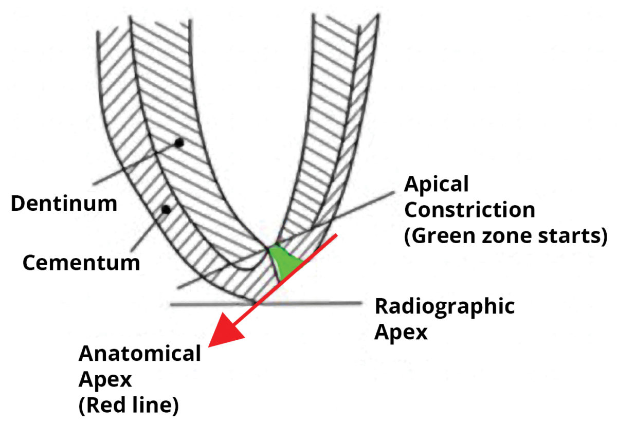 where-is-the-end-of-the-apex-endodontic-associates